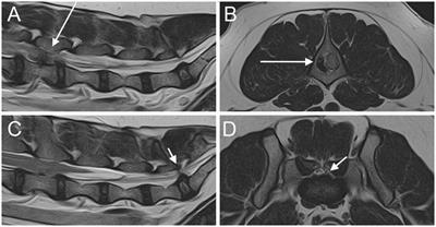 Prevalence, MRI findings, and clinical features of lumbosacral intervertebral disc protrusion in French Bulldogs diagnosed with acute thoracic or lumbar intervertebral disc extrusion